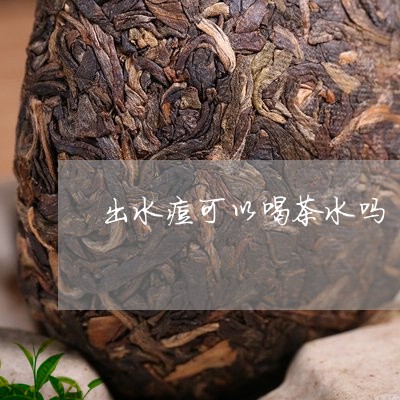 出水痘可以喝茶水吗/2023041660793