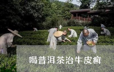 喝普洱茶治牛皮癣/2023041156268