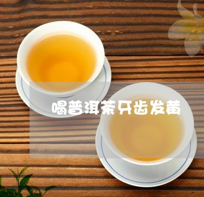 喝普洱茶牙齿发黄/2023041011927