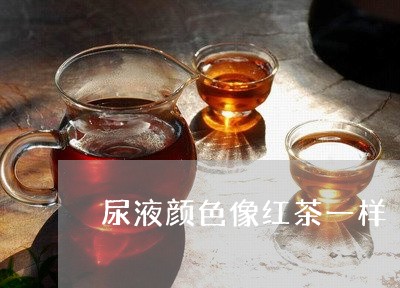 尿液颜色像红茶一样/2023031938462