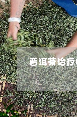 普洱茶治疗咳嗽吗/2023041070692