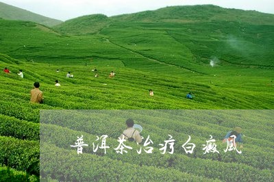 普洱茶治疗白癜风/2023031594926