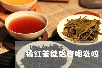 橘红茶能治疗咽炎吗/2023031944047