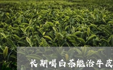 长期喝白茶能治牛皮癣吗/2023032926071