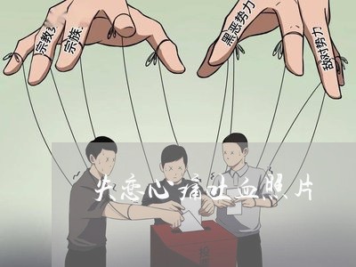 失恋心痛吐血照片/2023102736030