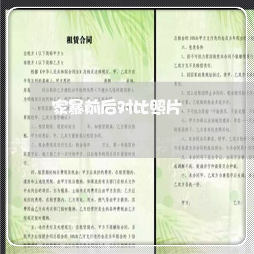 家暴前后对比照片/2023100927259