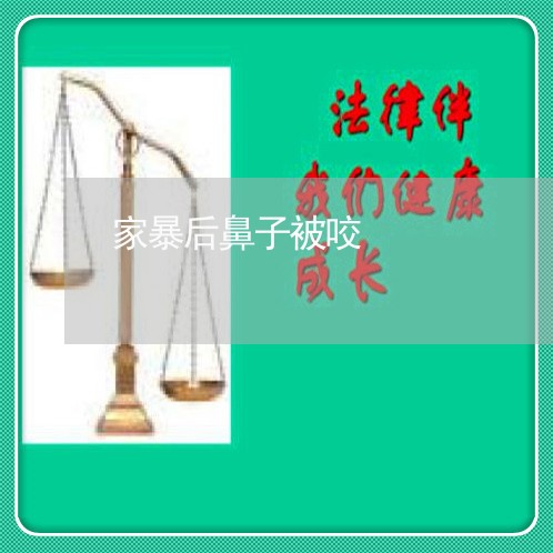 家暴后鼻子被咬/2023122156360