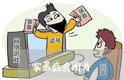 家暴疤痕图片/2023082593846